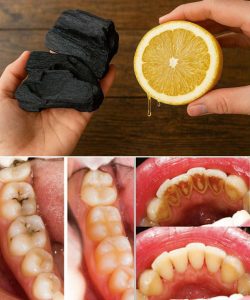 The magic of lemon juice and activated charcoal: Natural DIY solutions for skin and teeth