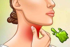 CAUSES OF MUCUS IN THE THROAT AND HOW TO DEAL WITH IT