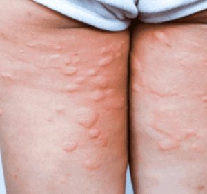 My 8-year-old has been experiencing this for two months — and it’s getting worse