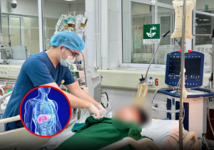 Post-Festival Wellness: Understanding the Impact on Your Liver