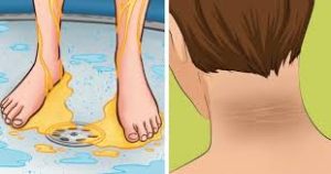 Could You Have Diabetes? 9 Symptoms Many Overlook in Their 20s and 30s