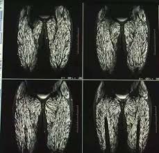 Can Food Carry Hidden Parasites? Understanding the Real Risks and How to Stay Safe