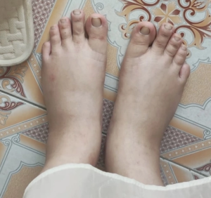 Your Feet May Be Trying to Tell You Something