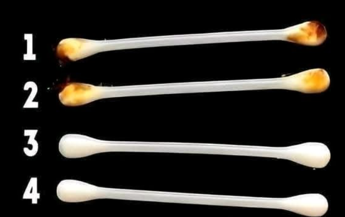 Wat uw oorhygiëne onthult over uw gezondheid Wat uw oorhygiëne onthult over uw gezondheid
