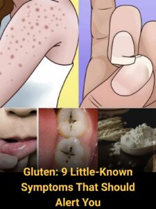 The Subtle Language of Nutrient Intolerance