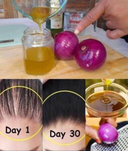 The Natural Path to Thicker Hair: Onion Oil Uncovered