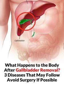 The Hidden Truth About Your Body’s Digestive Balance