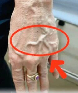 If you have visible veins, it means you are…