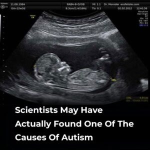 Decoding the Science Behind Fetal Scans and Early Neurodevelopment