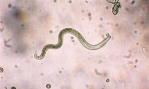The No.1 Vegetable Most Contaminated With Parasites