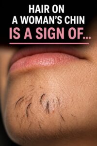 Is Your Chin Hair Trying to Tell You Something?