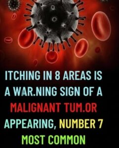 Persistent Itching Guide: 8 Body Areas and Vital Wellness Warning Signs