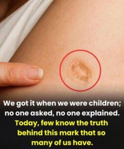 The Stories Behind the Circular Scar on Older Generations