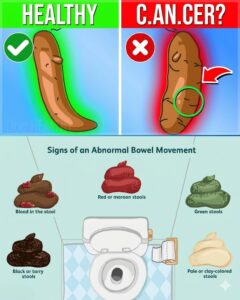 What Your Stool Color Reveals About Your Digestive And Overall Health
