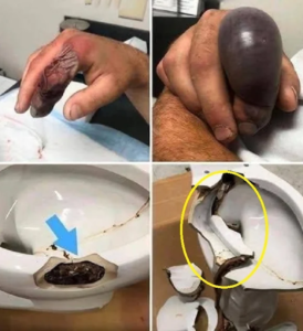 Horror Warning From Experts: Snakes Crawling Up Through Toilets Are Becoming More Common Than Many People Realize