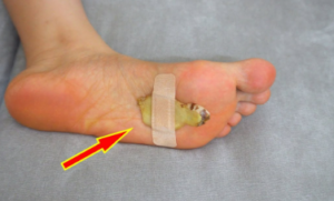 4 Surprising Benefits Of Putting Ginger On The Soles Of Your Feet Before Bed