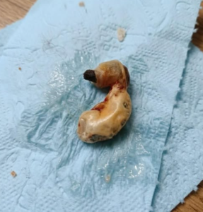 Mother Was Horrified After Finding This Strange Object Under Her Son’s Bed — The Truth Left Thousands Shocked