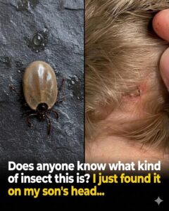 US Tick Bite Warning 2026: States, Maps & CDC Alert