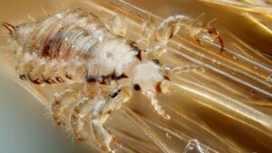 The Hidden Tick Parents Often Miss in Their Child’s Hair