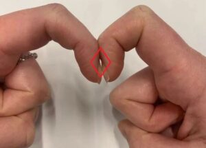 Doctors Say This Simple 5-Second Finger Test May Help Detect Warning Signs Linked To Lung Cancer