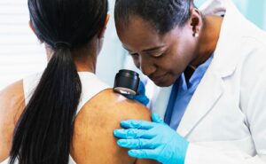 5 Dark Spots on Your Body That Could Be Warning Signs You Shouldn’t Ignore