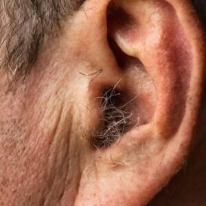 DID YOU KNOW? If Hair Starts Growing On Your Ears, Your Body May Be Trying To Tell You Something