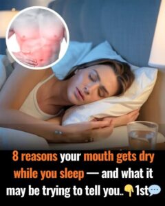 8 Reasons Your Mouth Gets Dry While You Sleep: What Is Your Body Telling You?