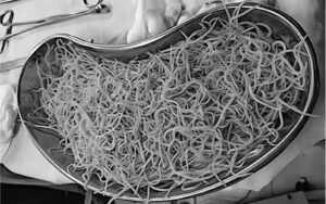 Boy Vomited Continuously For 3 Days — Doctors Were Shocked By What They Found Inside His Intestines