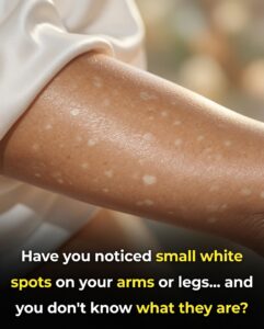 Small White Spots on Arms and Legs: Causes, Treatments, and Prevention