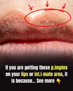 Understanding Tiny Bumps on Lips and Sensitive Areas: Causes and Care