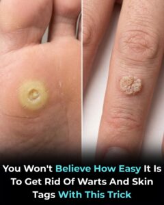 Discover simple ways to care for smooth skin naturally at home.