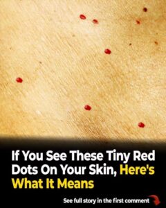 Tiny red dots on skin: causes, signs, and when to seek care.