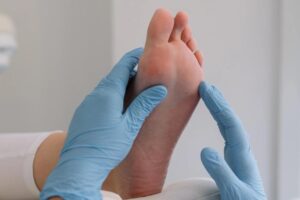 What Are Plantar Warts? Causes, Symptoms, and the Best Ways to Treat Them